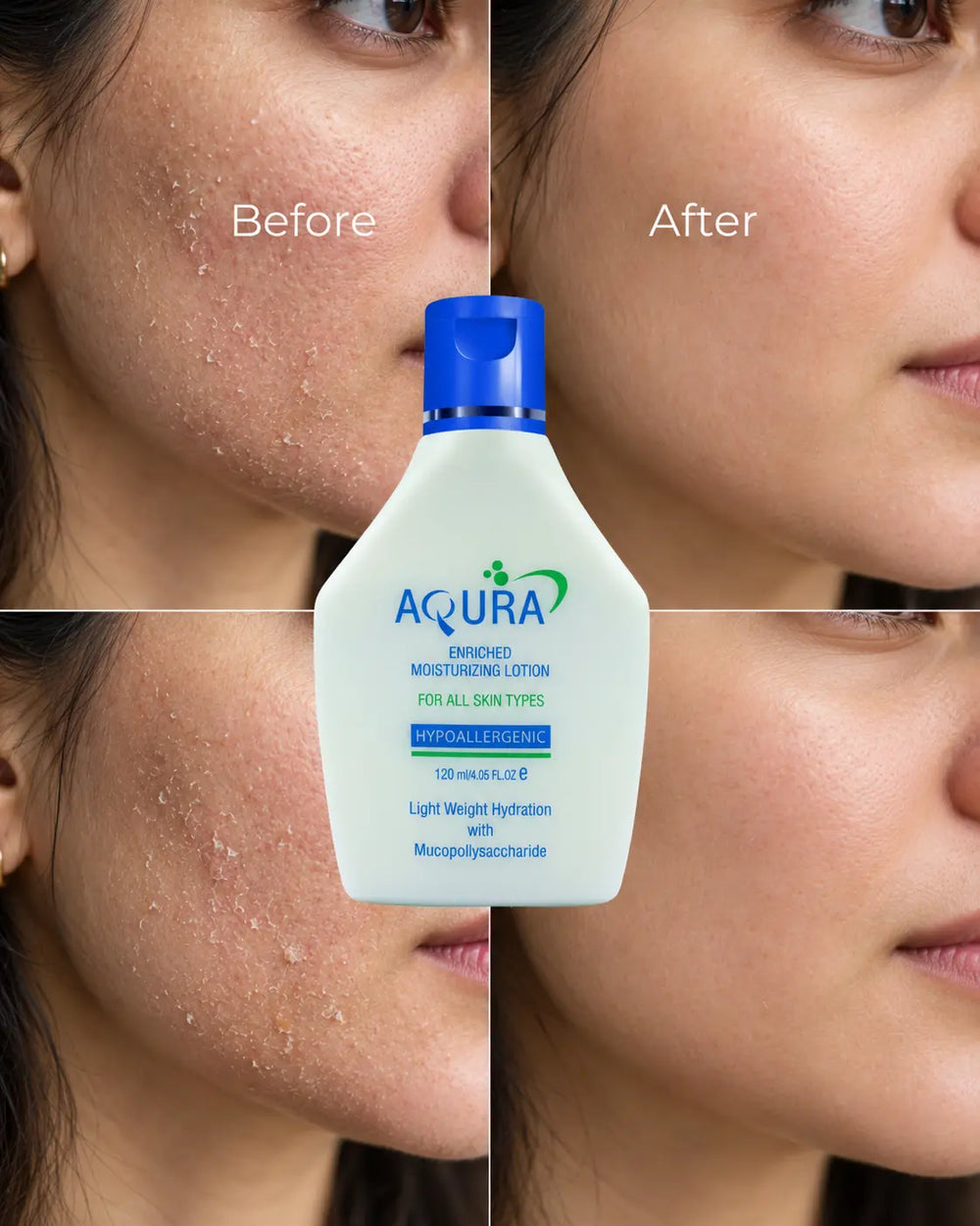 Skincare results