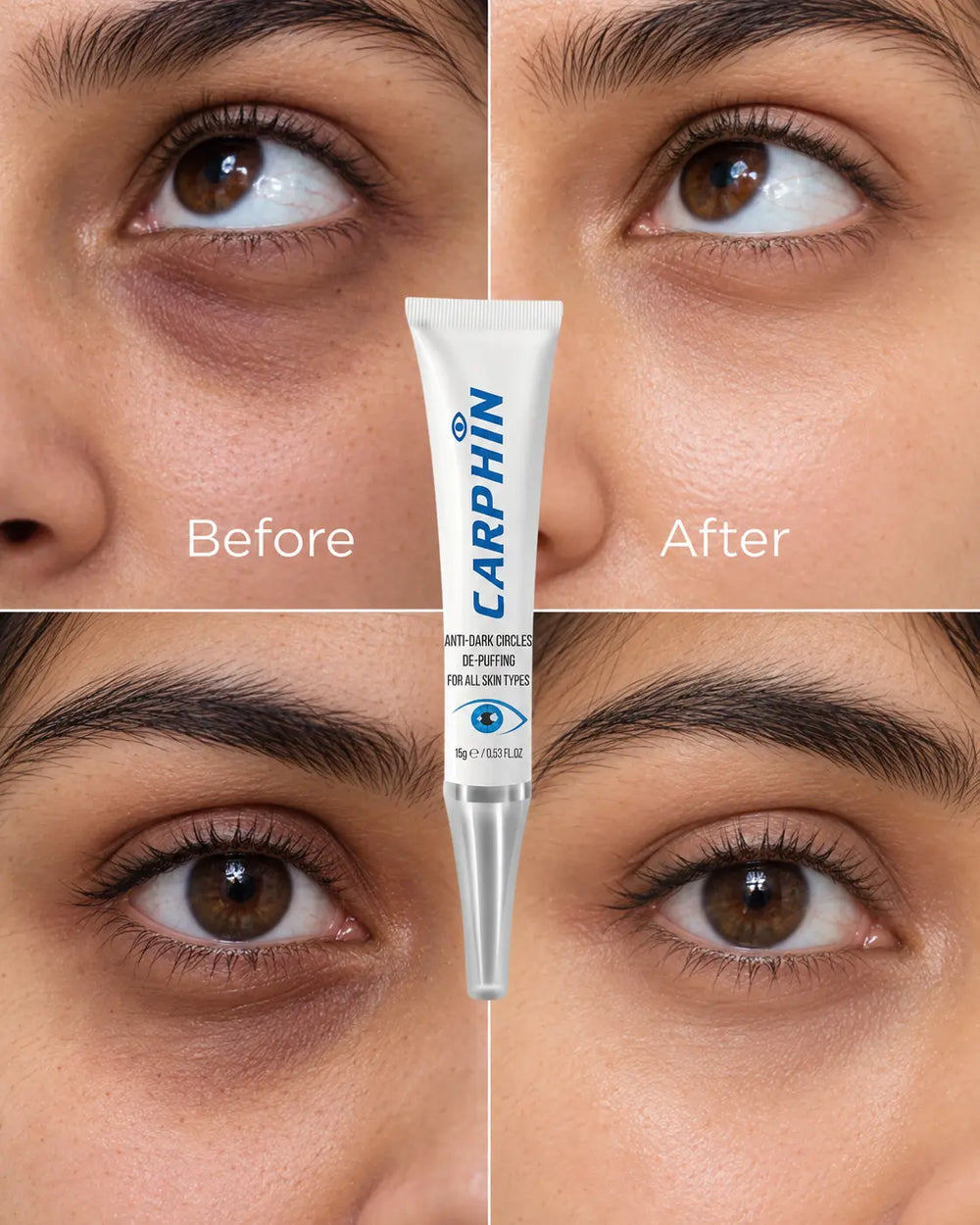 Skincare results
