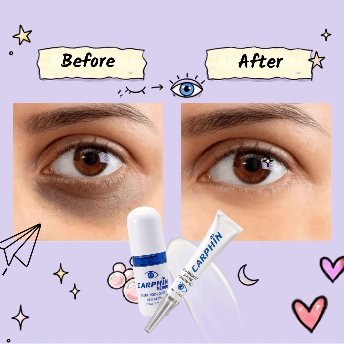 Carphin Eye Care Bundle Dark Circles & Puffiness - Caremon