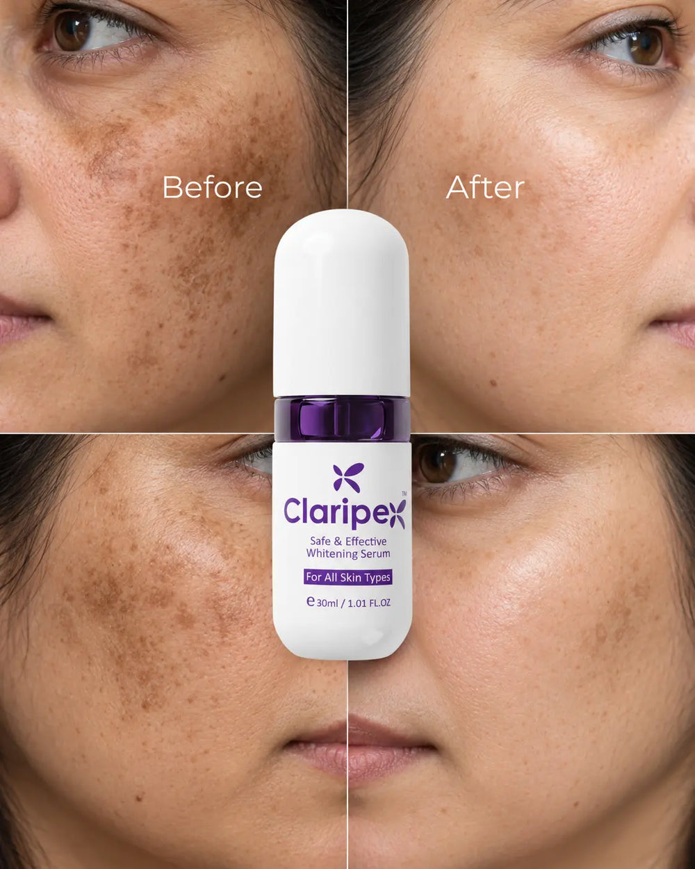 Skincare results