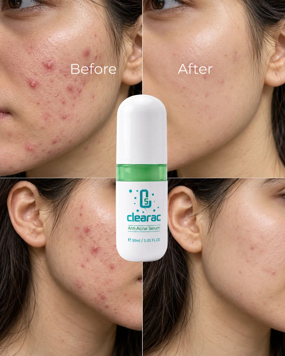 Skincare results