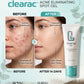 Clearac Gel Acne Spot Treatment 20g
