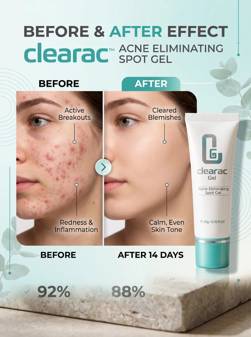 Clearac Gel Acne Spot Treatment 20g