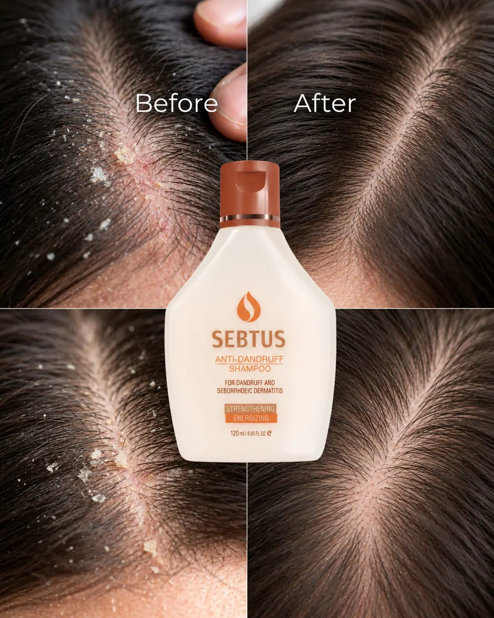 Skincare results